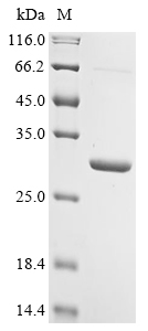 (Tris-Glycine gel) Discontinuous SDS-PAGE (reduced) with 5% enrichment gel and 15% separation gel. (Tris-Glycine gel) Discontinuous SDS-PAGE (reduced) with 5% enrichment gel and 15% separation gel.