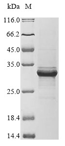 (Tris-Glycine gel) Discontinuous SDS-PAGE (reduced) with 5% enrichment gel and 15% separation gel. (Tris-Glycine gel) Discontinuous SDS-PAGE (reduced) with 5% enrichment gel and 15% separation gel.