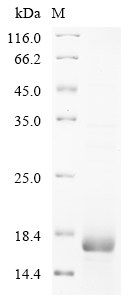 (Tris-Glycine gel) Discontinuous SDS-PAGE (reduced) with 5% enrichment gel and 15% separation gel. (Tris-Glycine gel) Discontinuous SDS-PAGE (reduced) with 5% enrichment gel and 15% separation gel.