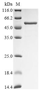 Recombinant Human Pregnancy-specific beta-1-glycoprotein 1 (PSG1) - image 1