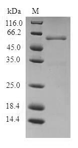(Tris-Glycine gel) Discontinuous SDS-PAGE (reduced) with 5% enrichment gel and 15% separation gel. (Tris-Glycine gel) Discontinuous SDS-PAGE (reduced) with 5% enrichment gel and 15% separation gel.