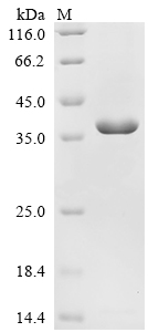 Recombinant Human Proteasome activator complex subunit 3 (PSME3) - image 1