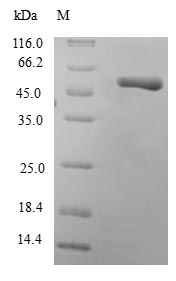 (Tris-Glycine gel) Discontinuous SDS-PAGE (reduced) with 5% enrichment gel and 15% separation gel. (Tris-Glycine gel) Discontinuous SDS-PAGE (reduced) with 5% enrichment gel and 15% separation gel.