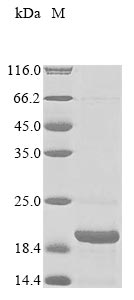 (Tris-Glycine gel) Discontinuous SDS-PAGE (reduced) with 5% enrichment gel and 15% separation gel. (Tris-Glycine gel) Discontinuous SDS-PAGE (reduced) with 5% enrichment gel and 15% separation gel.