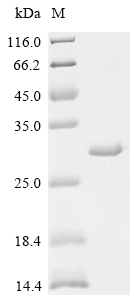 (Tris-Glycine gel) Discontinuous SDS-PAGE (reduced) with 5% enrichment gel and 15% separation gel.