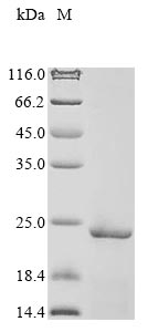 (Tris-Glycine gel) Discontinuous SDS-PAGE (reduced) with 5% enrichment gel and 15% separation gel. (Tris-Glycine gel) Discontinuous SDS-PAGE (reduced) with 5% enrichment gel and 15% separation gel.
