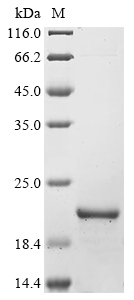 (Tris-Glycine gel) Discontinuous SDS-PAGE (reduced) with 5% enrichment gel and 15% separation gel. (Tris-Glycine gel) Discontinuous SDS-PAGE (reduced) with 5% enrichment gel and 15% separation gel.