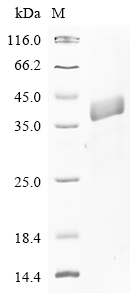 (Tris-Glycine gel) Discontinuous SDS-PAGE (reduced) with 5% enrichment gel and 15% separation gel.