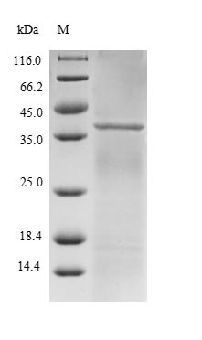 (Tris-Glycine gel) Discontinuous SDS-PAGE (reduced) with 5% enrichment gel and 15% separation gel. (Tris-Glycine gel) Discontinuous SDS-PAGE (reduced) with 5% enrichment gel and 15% separation gel.