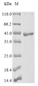 Recombinant Human Ras GTPase-activating protein 1 (RASA1) , partial - image 1