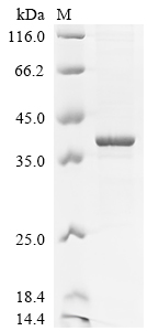 (Tris-Glycine gel) Discontinuous SDS-PAGE (reduced) with 5% enrichment gel and 15% separation gel.