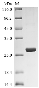 Recombinant Rat Retinol-binding protein 4 (Rbp4) - image 1