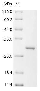 Recombinant Human ATP-dependent DNA helicase Q5 (RECQL5) , partial - image 1