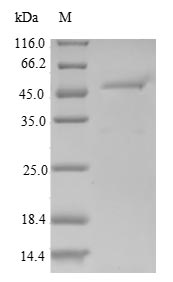 (Tris-Glycine gel) Discontinuous SDS-PAGE (reduced) with 5% enrichment gel and 15% separation gel. (Tris-Glycine gel) Discontinuous SDS-PAGE (reduced) with 5% enrichment gel and 15% separation gel.