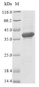 (Tris-Glycine gel) Discontinuous SDS-PAGE (reduced) with 5% enrichment gel and 15% separation gel. (Tris-Glycine gel) Discontinuous SDS-PAGE (reduced) with 5% enrichment gel and 15% separation gel.