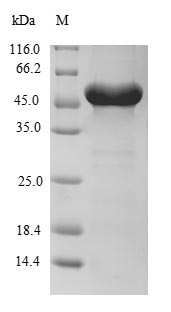 (Tris-Glycine gel) Discontinuous SDS-PAGE (reduced) with 5% enrichment gel and 15% separation gel. (Tris-Glycine gel) Discontinuous SDS-PAGE (reduced) with 5% enrichment gel and 15% separation gel.
