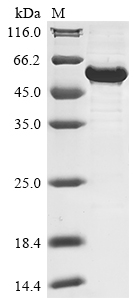 Recombinant Human Nuclear receptor ROR-alpha (RORA) - image 1
