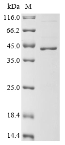 (Tris-Glycine gel) Discontinuous SDS-PAGE (reduced) with 5% enrichment gel and 15% separation gel. (Tris-Glycine gel) Discontinuous SDS-PAGE (reduced) with 5% enrichment gel and 15% separation gel.