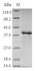 (Tris-Glycine gel) Discontinuous SDS-PAGE (reduced) with 5% enrichment gel and 15% separation gel. (Tris-Glycine gel) Discontinuous SDS-PAGE (reduced) with 5% enrichment gel and 15% separation gel.