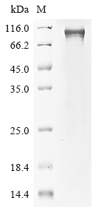 (Tris-Glycine gel) Discontinuous SDS-PAGE (reduced) with 5% enrichment gel and 15% separation gel. (Tris-Glycine gel) Discontinuous SDS-PAGE (reduced) with 5% enrichment gel and 15% separation gel.
