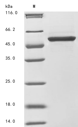 (Tris-Glycine gel) Discontinuous SDS-PAGE (reduced) with 5% enrichment gel and 15% separation gel. (Tris-Glycine gel) Discontinuous SDS-PAGE (reduced) with 5% enrichment gel and 15% separation gel.