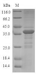 (Tris-Glycine gel) Discontinuous SDS-PAGE (reduced) with 5% enrichment gel and 15% separation gel. (Tris-Glycine gel) Discontinuous SDS-PAGE (reduced) with 5% enrichment gel and 15% separation gel.