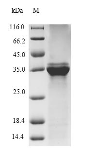 (Tris-Glycine gel) Discontinuous SDS-PAGE (reduced) with 5% enrichment gel and 15% separation gel. (Tris-Glycine gel) Discontinuous SDS-PAGE (reduced) with 5% enrichment gel and 15% separation gel.