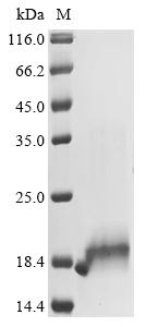 Recombinant Mouse Protein S100-B (S100b) - image 1
