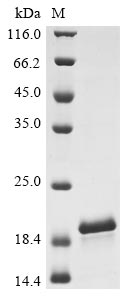 Recombinant Sheep Serum amyloid A protein (SAA1) - image 1