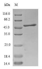 (Tris-Glycine gel) Discontinuous SDS-PAGE (reduced) with 5% enrichment gel and 15% separation gel. (Tris-Glycine gel) Discontinuous SDS-PAGE (reduced) with 5% enrichment gel and 15% separation gel.