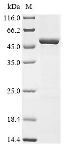 (Tris-Glycine gel) Discontinuous SDS-PAGE (reduced) with 5% enrichment gel and 15% separation gel. (Tris-Glycine gel) Discontinuous SDS-PAGE (reduced) with 5% enrichment gel and 15% separation gel.