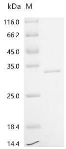 Recombinant Human Mammaglobin-B (SCGB2A1) - image 1