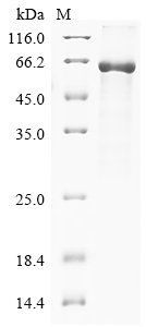 (Tris-Glycine gel) Discontinuous SDS-PAGE (reduced) with 5% enrichment gel and 15% separation gel. (Tris-Glycine gel) Discontinuous SDS-PAGE (reduced) with 5% enrichment gel and 15% separation gel.