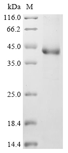 (Tris-Glycine gel) Discontinuous SDS-PAGE (reduced) with 5% enrichment gel and 15% separation gel. (Tris-Glycine gel) Discontinuous SDS-PAGE (reduced) with 5% enrichment gel and 15% separation gel.