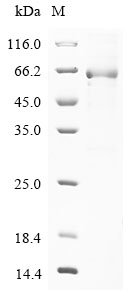 (Tris-Glycine gel) Discontinuous SDS-PAGE (reduced) with 5% enrichment gel and 15% separation gel. (Tris-Glycine gel) Discontinuous SDS-PAGE (reduced) with 5% enrichment gel and 15% separation gel.