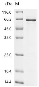 Recombinant Human Sestrin-2 (SESN2) - image 1