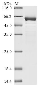 (Tris-Glycine gel) Discontinuous SDS-PAGE (reduced) with 5% enrichment gel and 15% separation gel. (Tris-Glycine gel) Discontinuous SDS-PAGE (reduced) with 5% enrichment gel and 15% separation gel.