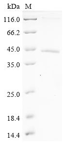 (Tris-Glycine gel) Discontinuous SDS-PAGE (reduced) with 5% enrichment gel and 15% separation gel. (Tris-Glycine gel) Discontinuous SDS-PAGE (reduced) with 5% enrichment gel and 15% separation gel.