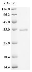 Recombinant Mouse Sialate O-acetylesterase (Siae) - image 1