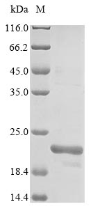 (Tris-Glycine gel) Discontinuous SDS-PAGE (reduced) with 5% enrichment gel and 15% separation gel. (Tris-Glycine gel) Discontinuous SDS-PAGE (reduced) with 5% enrichment gel and 15% separation gel.