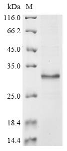 Recombinant Human Reduced folate transporter (SLC19A1) , partial - image 1