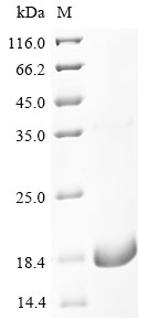 (Tris-Glycine gel) Discontinuous SDS-PAGE (reduced) with 5% enrichment gel and 15% separation gel. (Tris-Glycine gel) Discontinuous SDS-PAGE (reduced) with 5% enrichment gel and 15% separation gel.