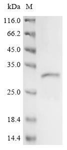 Recombinant Human Solute carrier family 22 member 1 (SLC22A1) , partial - image 1