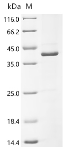 Recombinant Human Pendrin (SLC26A4) , partial - image 1