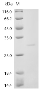 Recombinant Human Sodium-dependent phosphate transport protein 2B (SLC34A2) , partial - image 1