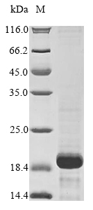 Recombinant Human Antileukoproteinase (SLPI) - image 1