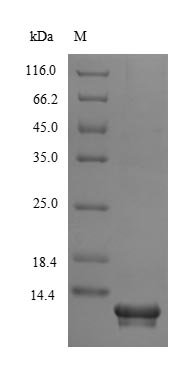 (Tris-Glycine gel) Discontinuous SDS-PAGE (reduced) with 5% enrichment gel and 15% separation gel. (Tris-Glycine gel) Discontinuous SDS-PAGE (reduced) with 5% enrichment gel and 15% separation gel.