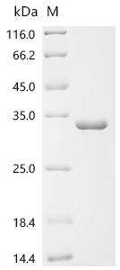 Recombinant Human Probable global transcription activator SNF2L2 (SMARCA2) , partial - image 1