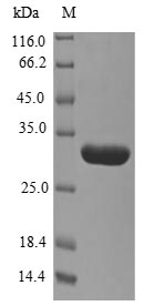 (Tris-Glycine gel) Discontinuous SDS-PAGE (reduced) with 5% enrichment gel and 15% separation gel. (Tris-Glycine gel) Discontinuous SDS-PAGE (reduced) with 5% enrichment gel and 15% separation gel.