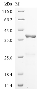 (Tris-Glycine gel) Discontinuous SDS-PAGE (reduced) with 5% enrichment gel and 15% separation gel. (Tris-Glycine gel) Discontinuous SDS-PAGE (reduced) with 5% enrichment gel and 15% separation gel.